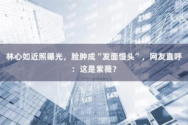 林心如近照曝光，脸肿成“发面馒头”，网友直呼：这是紫薇？